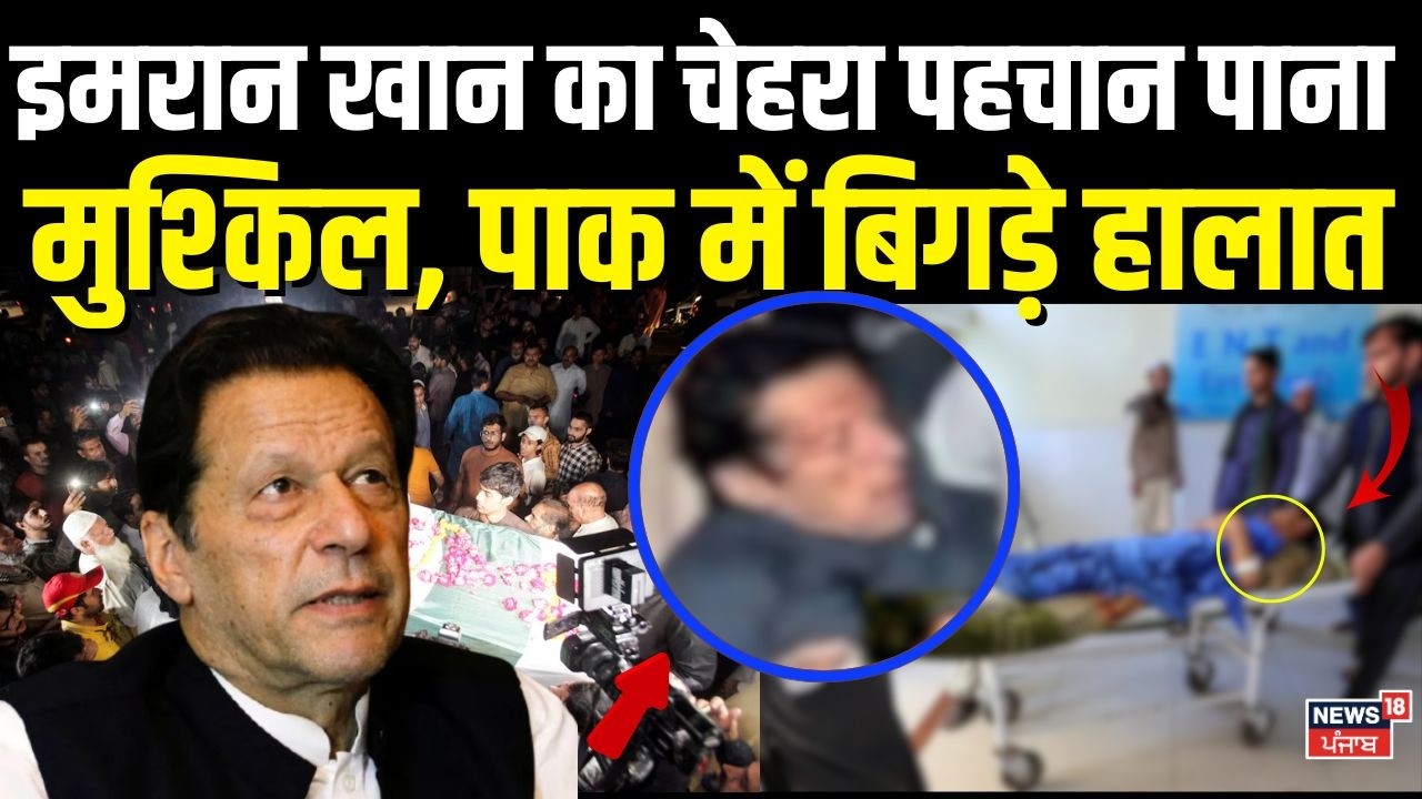 Imran Khan Health Update : इमरान खान का चेहरा पहचान पाना मुश्किल, पाक में बिगड़े हालात | N18G
