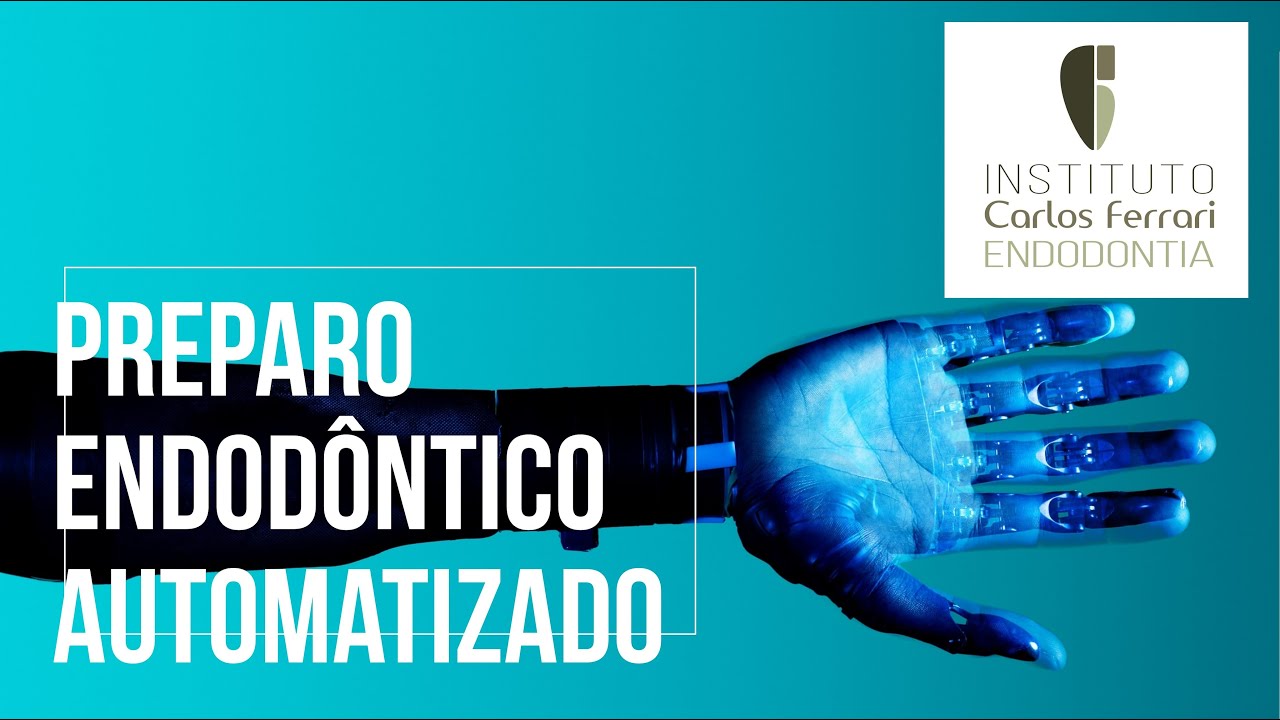 Preparo endodôntico automatizado