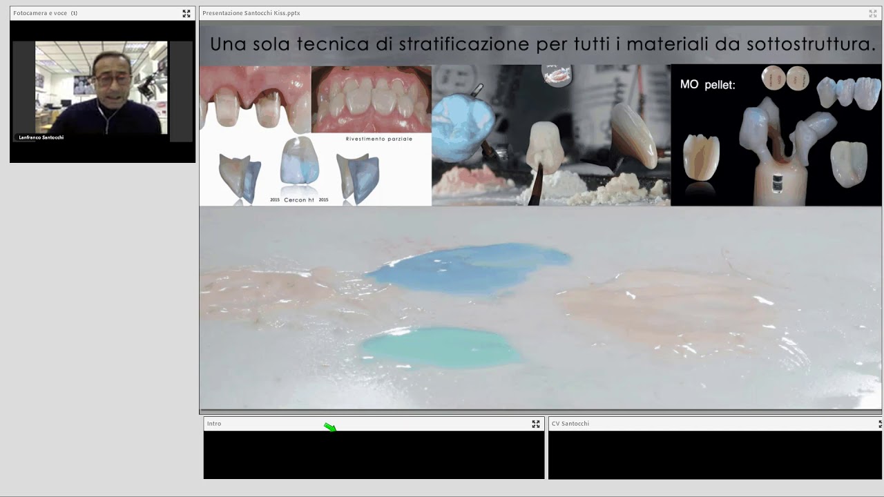 Duceram Kiss: stratificazione semplificata