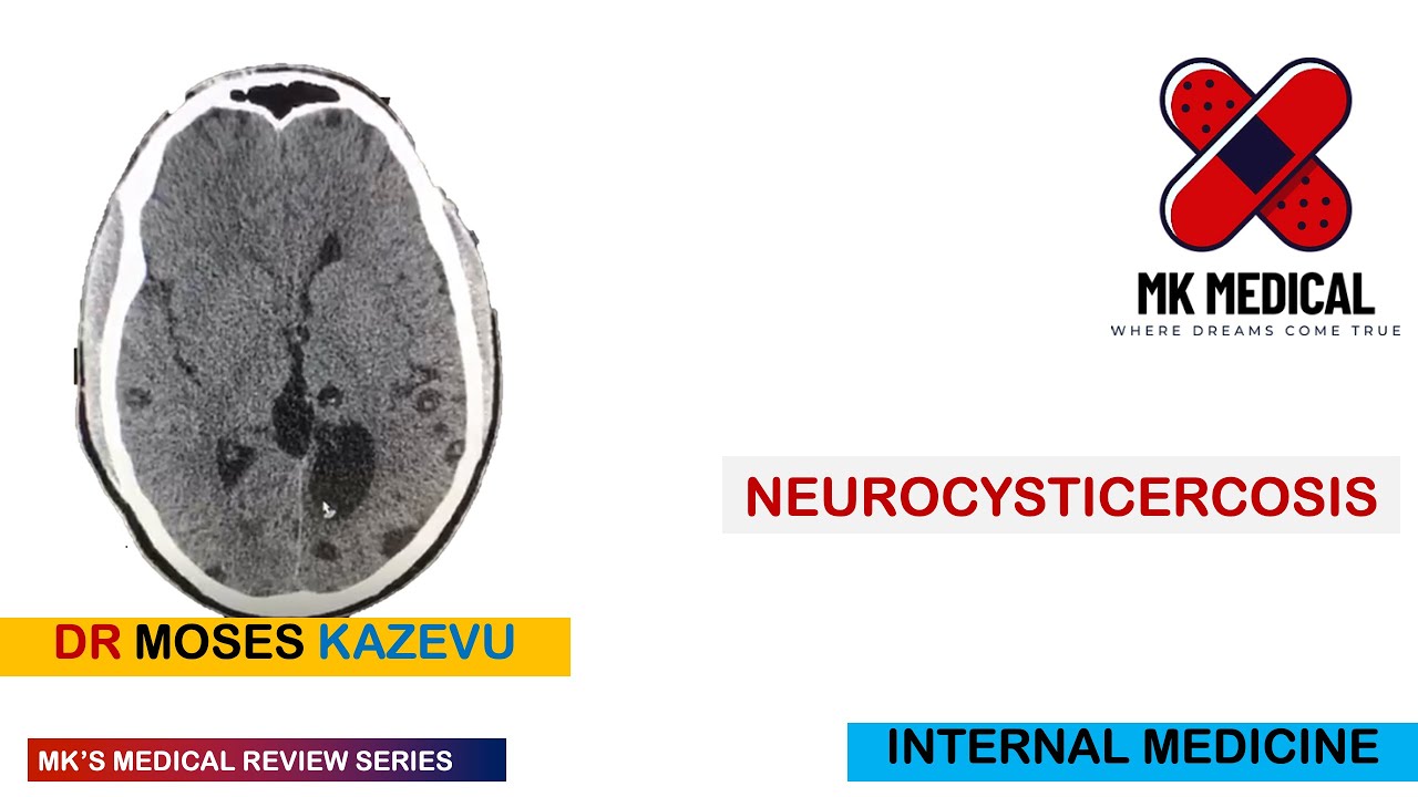 Neurocysticercosis
