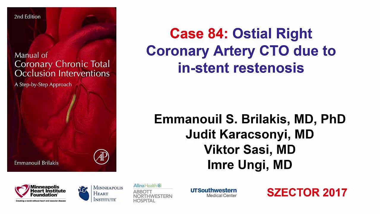 Case 84: Manual of CTO Interventions - Ostial right coronary artery CTO due to ISR