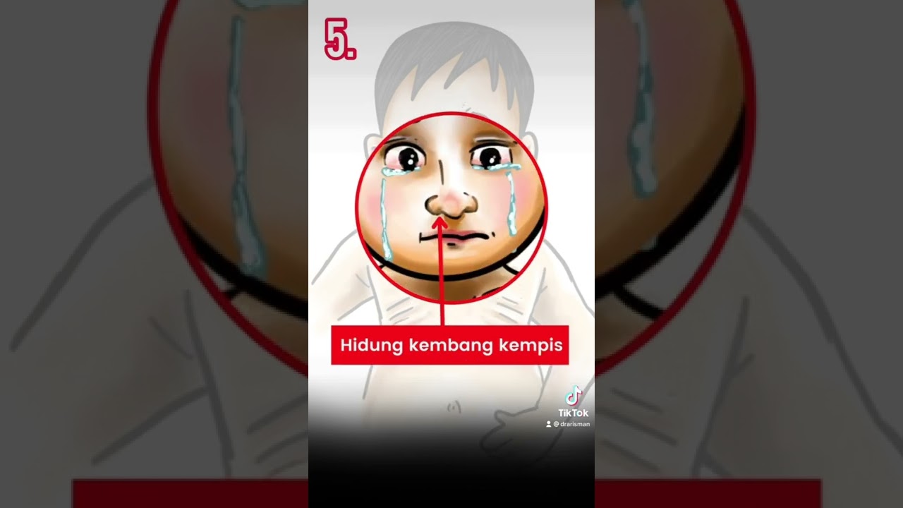 7 tanda bayi sesak nafas. Ibu bapa perlu tahu ini. #learnonyoutube