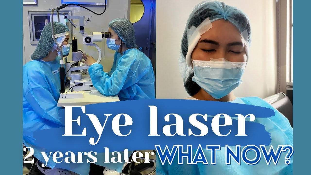SMILE Eye Surgery update! Side effects and what I noticed | Cyden Yap Philippines | Larrazabal eye