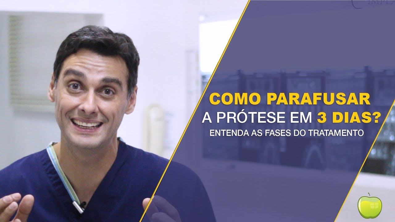 Parafusar a Prótese com Implantes logo após a Cirurgia, ou Não? (Entenda as Fases do Tratamento)