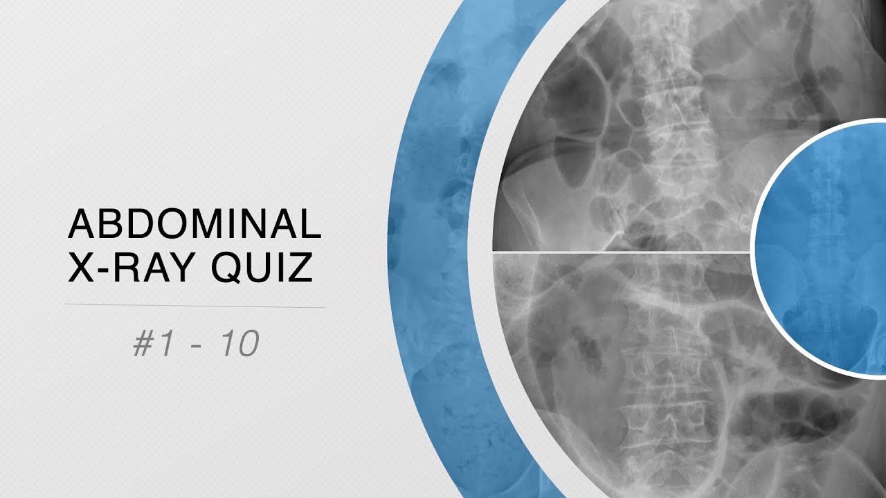 Abdominal X-ray Quiz #1 - 10