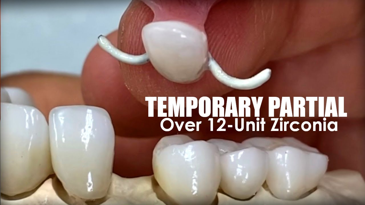 Step-By-Step: How I Make Temporary Partial Over 12-Unit Zirconia Restoration