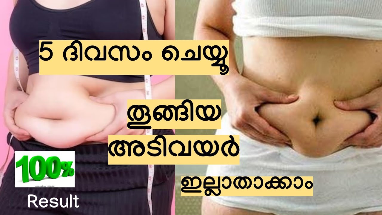 5 ദിവസം ചെയ്യൂ, തൂങ്ങിയ അടിവയർ ഇല്ലാതാക്കാം // Belly fat reduction - Malayalam 