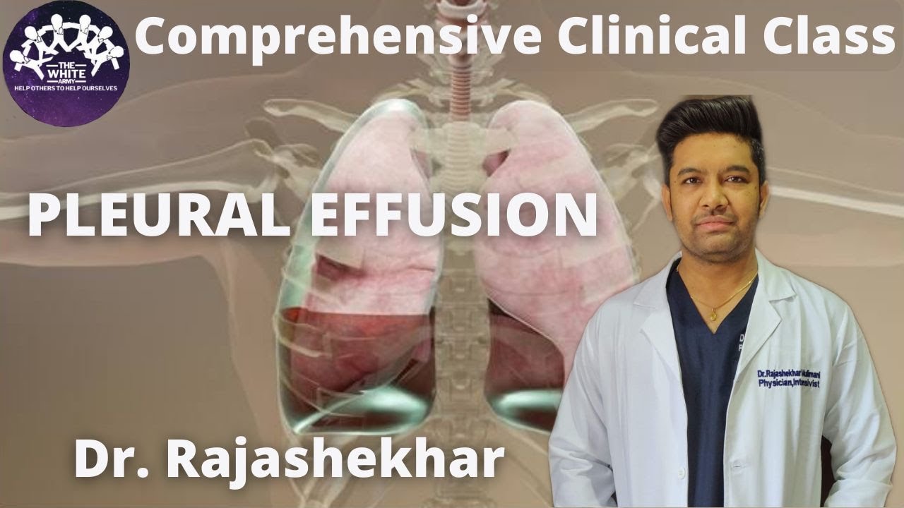 PLEURAL EFFUSION Clinical case presentation