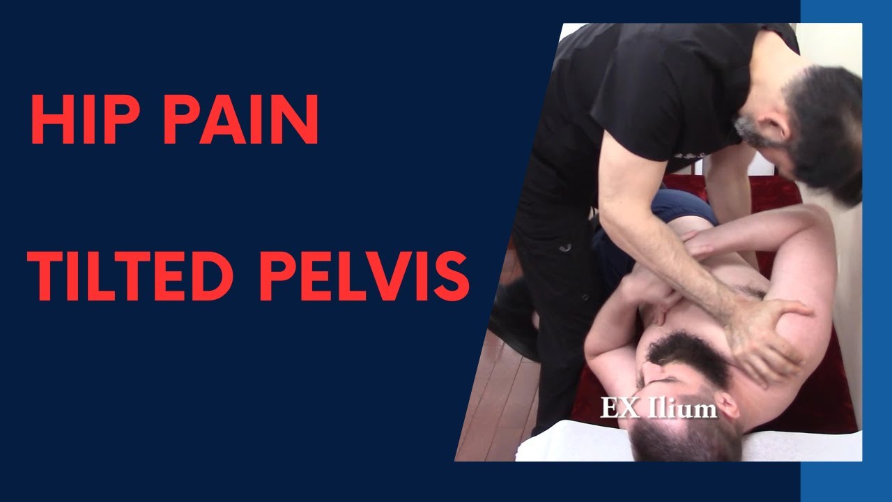 Hip Pain on Tilted Pelvis HELPED by Dr Suh