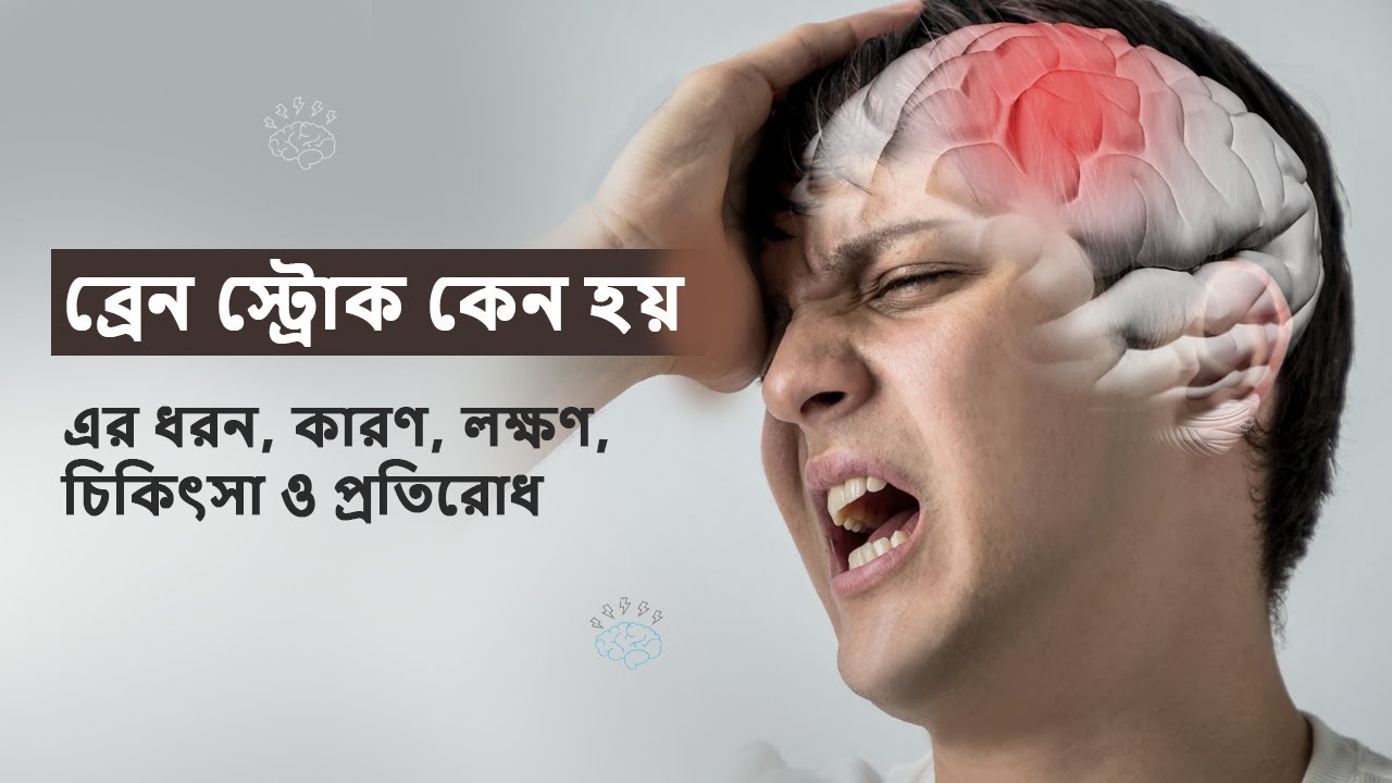 ব্রেন স্ট্রোক কেন হয় - why brain stroke occurs