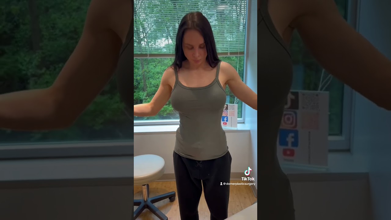 Наша пациентка делится с вами своим опытом удаления ребер. #удалениеребер #операцияпоудалениюребе...