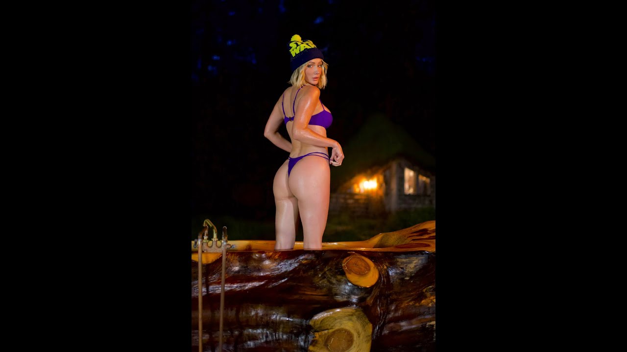 Sculptra Butt Lift Sarah Underwood and Plastic Surgeon Dr. R. Parikh Seattle Bellevue