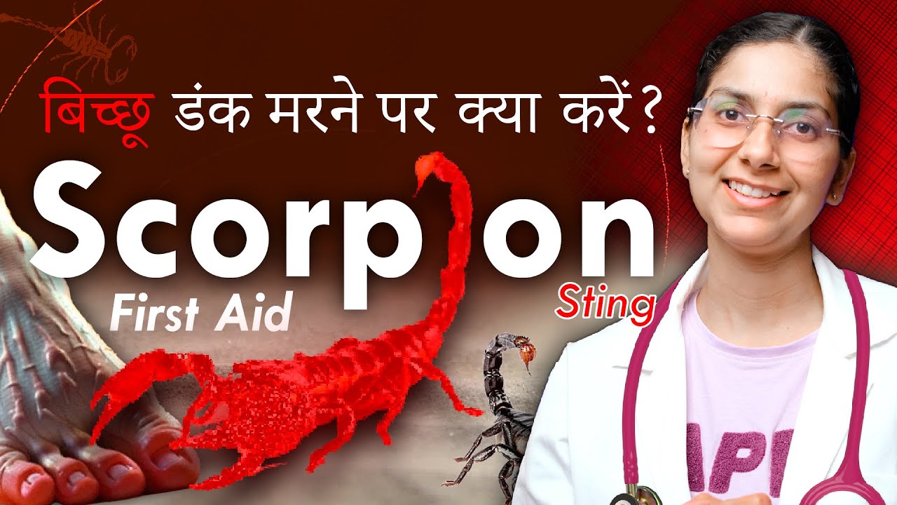 🚑First Aid - 🦂Scorpion Bite [बिच्छू के डंक करने पर क्या करें] | Dr. Richa Tiwari title