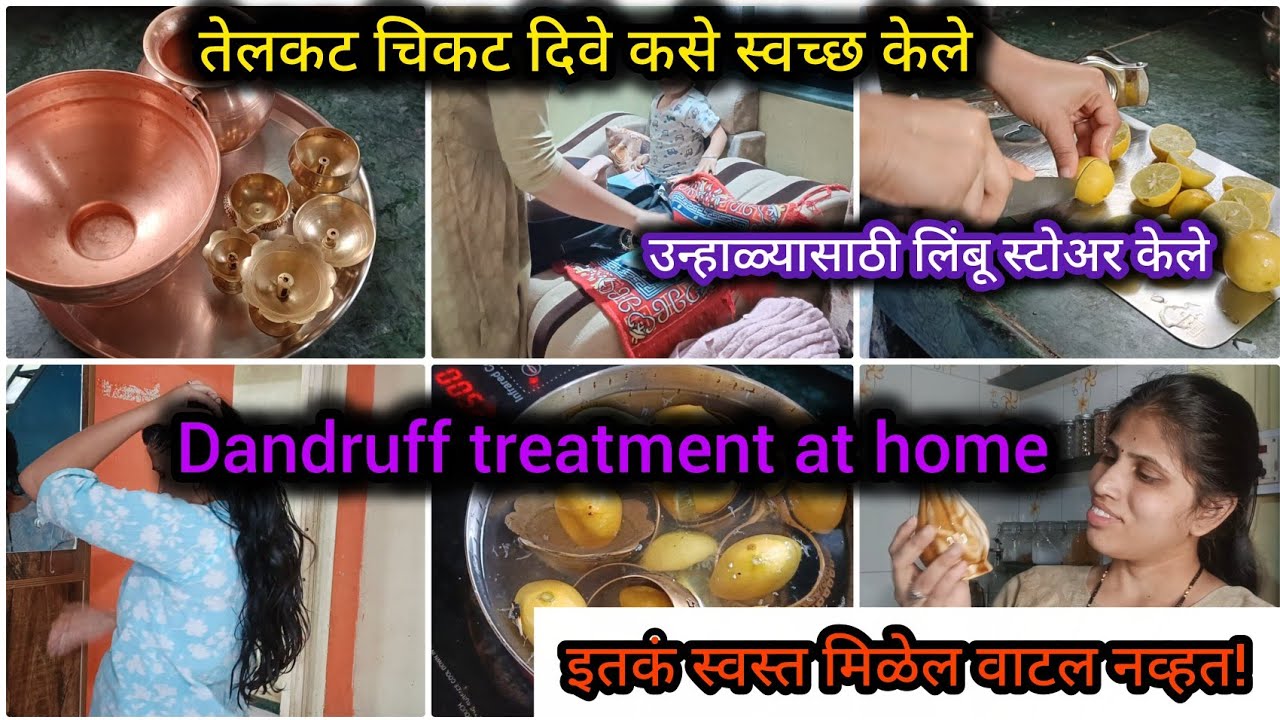 न घासता तेलकट चिकट दिवे कसे स्वच्छ केले?अगदी स्वस्तात केली खूप काही खरेदी/dandruff treatment at home