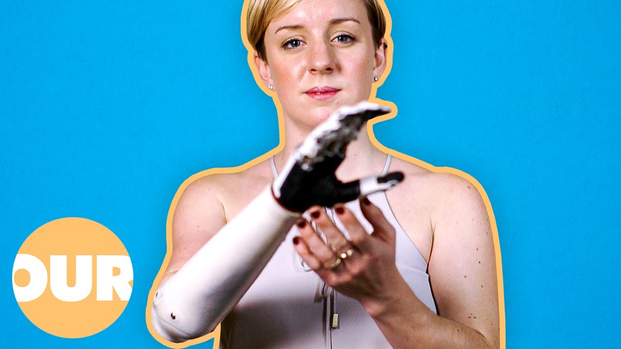 The Woman With A Bionic Arm | Our Life