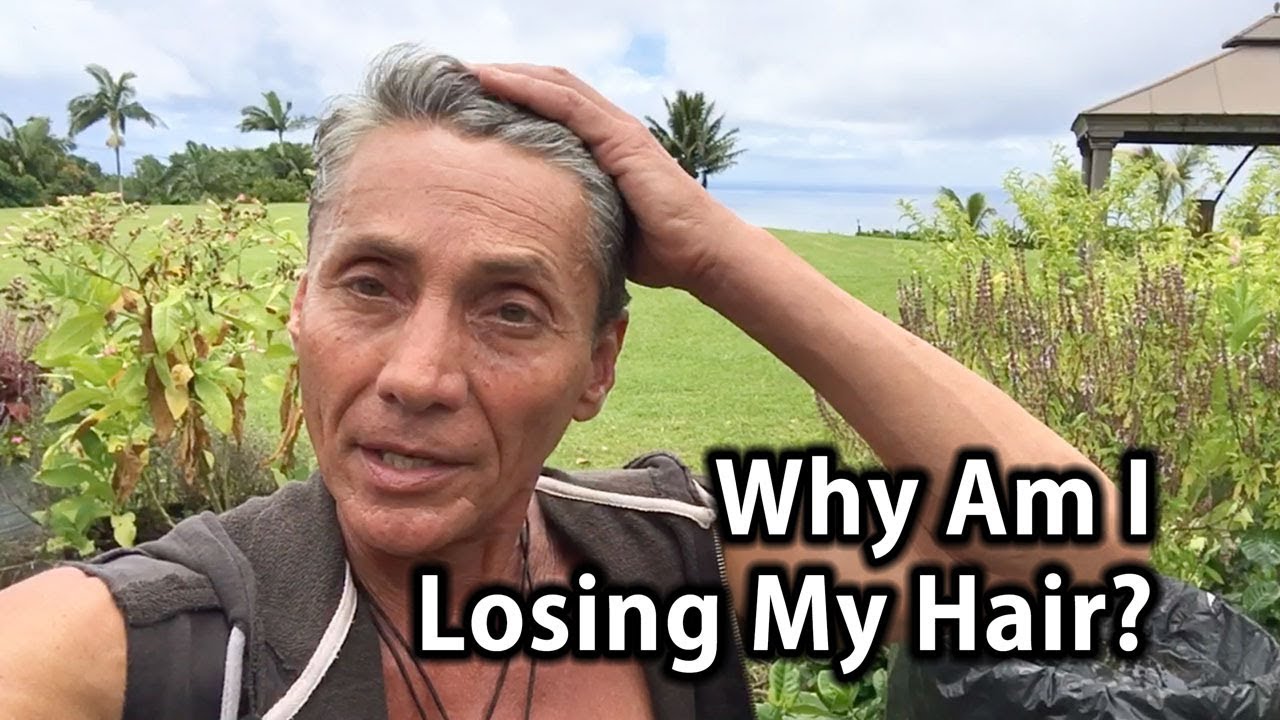Why Am I Losing My Hair? | Tip Of The Day | Dr. Robert Cassar