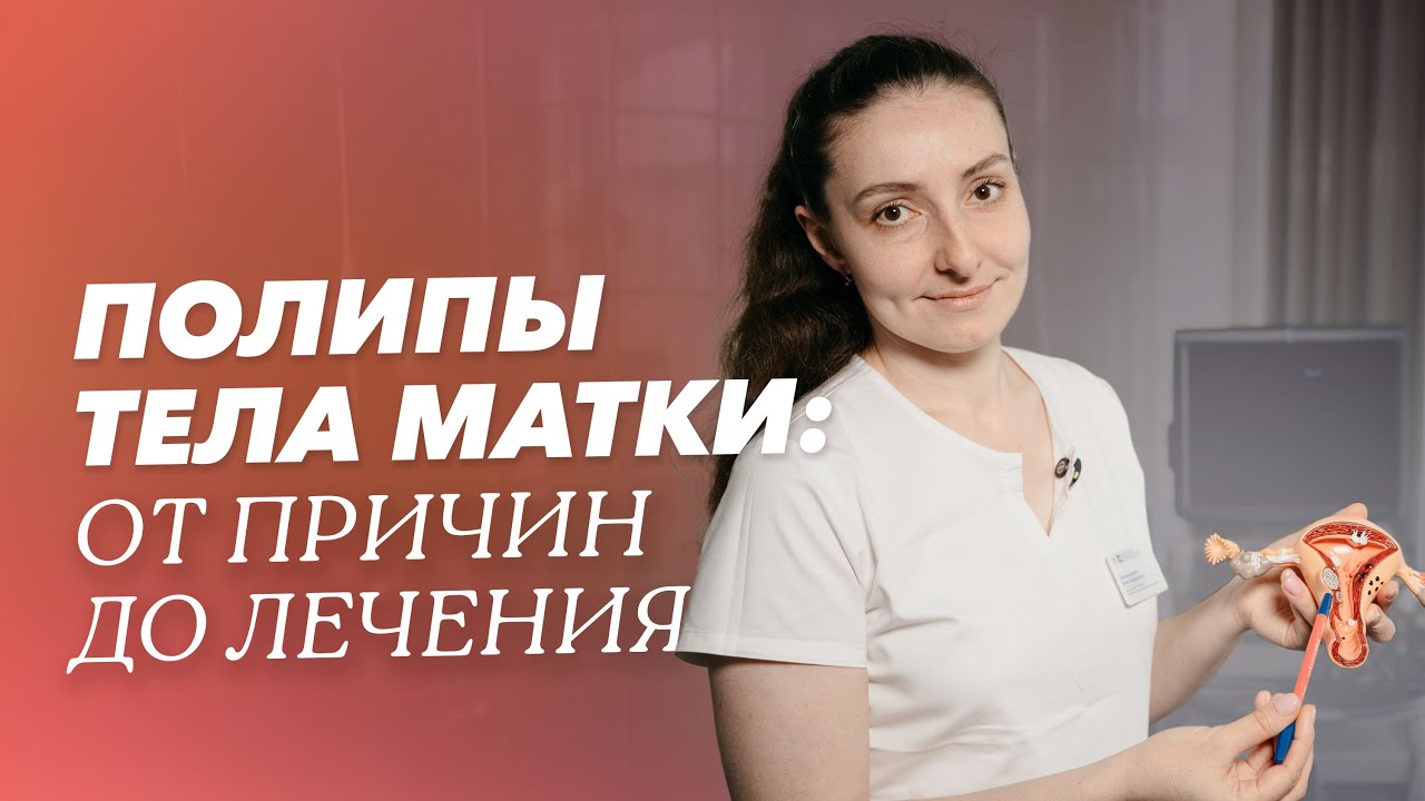Полипы тела матки: симптомы, диагностика и лечение