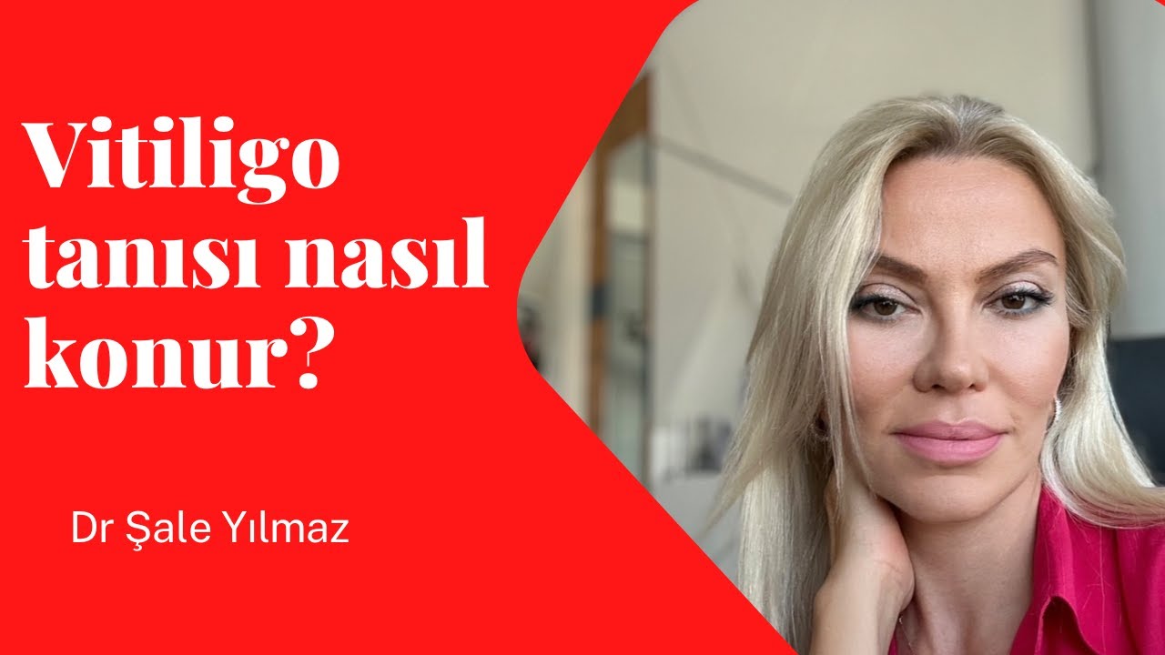 VİTİLİGO TANISI NASIL KONUR? HER BEYAZ LEKE VİTİLİGO MU? Dr ŞALE YILMAZ