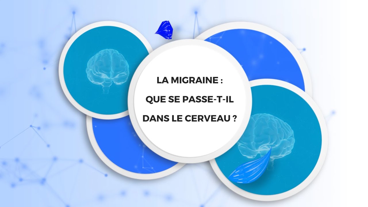 La migraine : que se passe-t-il dans le cerveau ?