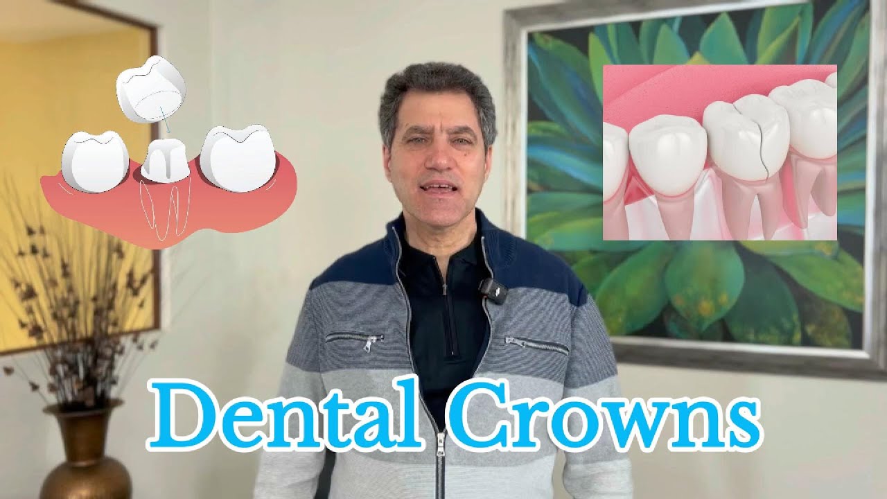 Dental Crowns