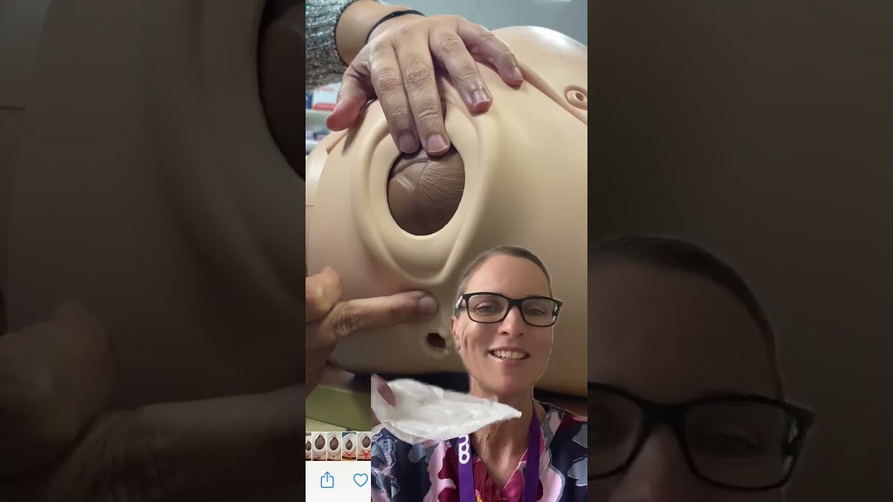 Prevent episiotomy and tearing during childbirth with perineal myofascial release and warm compress
