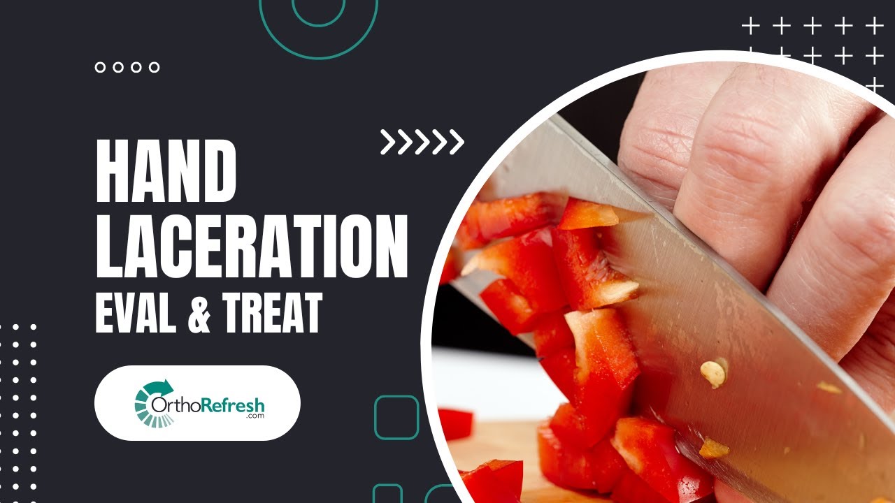 How to examine a cut finger - Evaluation and Treatment of the Lacerated Hand
