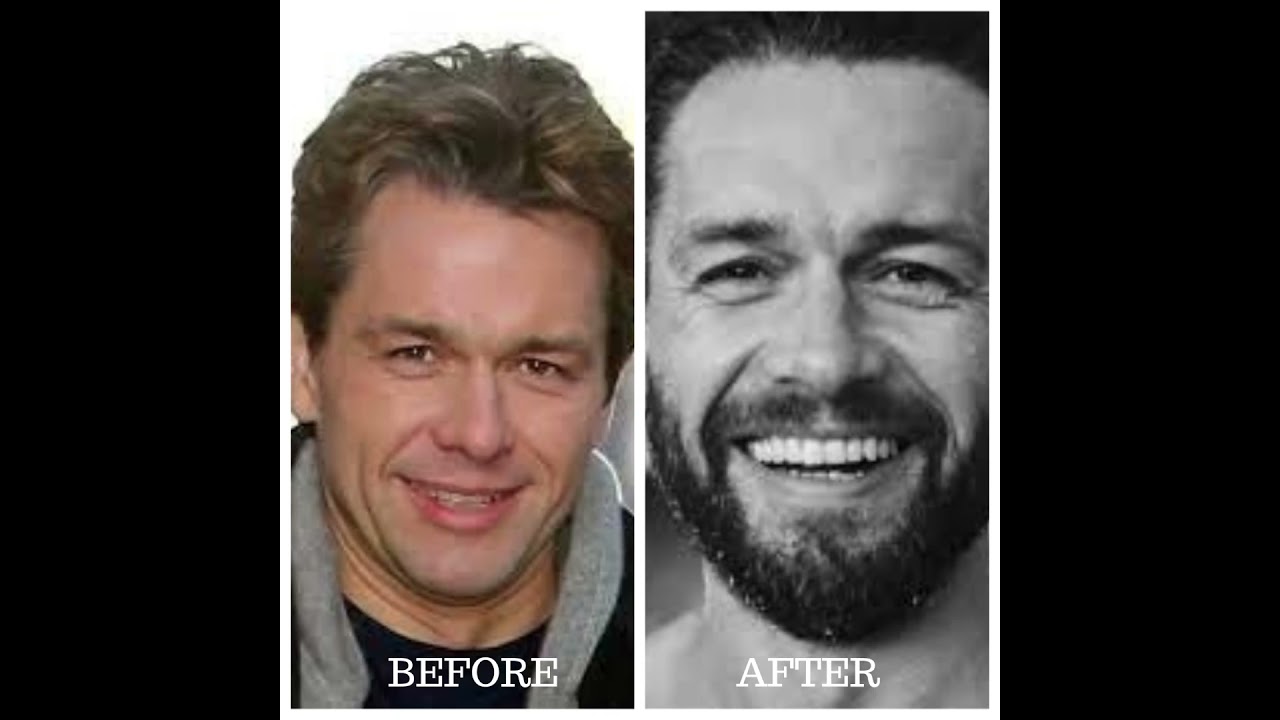 BRIDGERTON BEFORE AND AFTER - Antes e depois