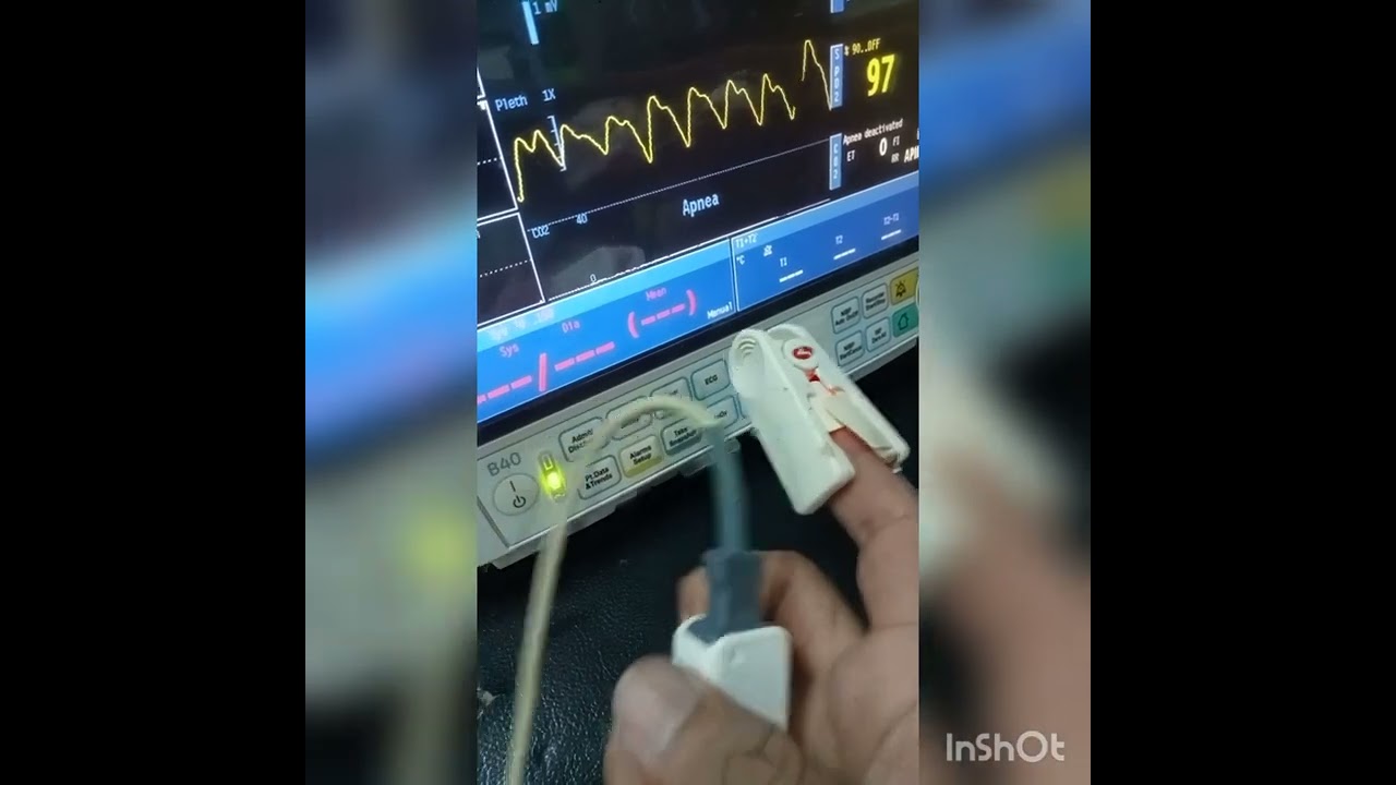G.E B40 patient monitor basic trouble shooting