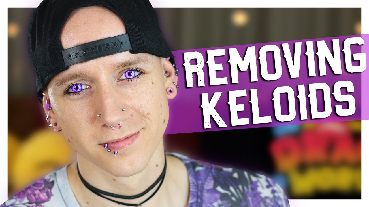 Piercing Keloids, Bumps & Hypertrophic Scars | Piercing FAQ 18 | Roly