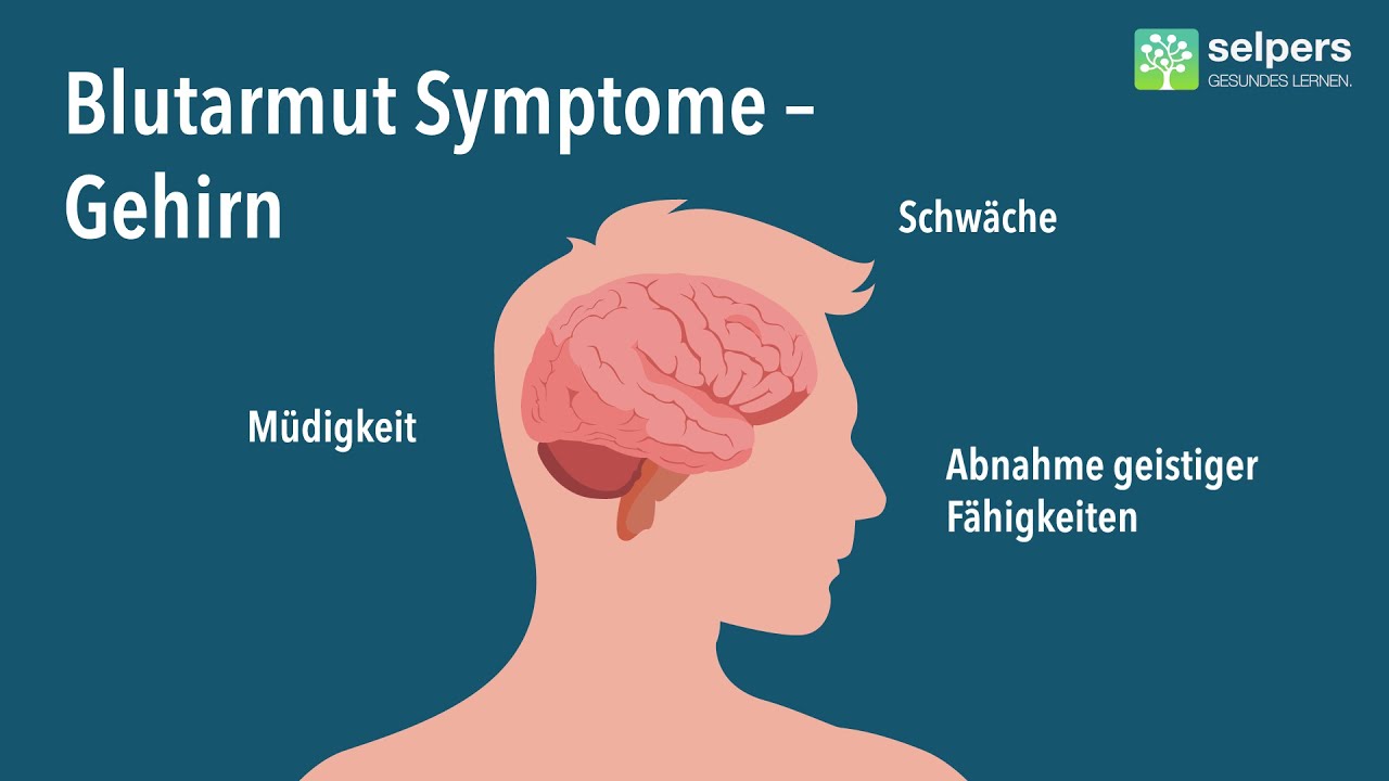 Symptome bei MDS (Myelodysplastisches Syndrom): Blutarmut | An&auml;mie (Experte erkl&auml;rt)