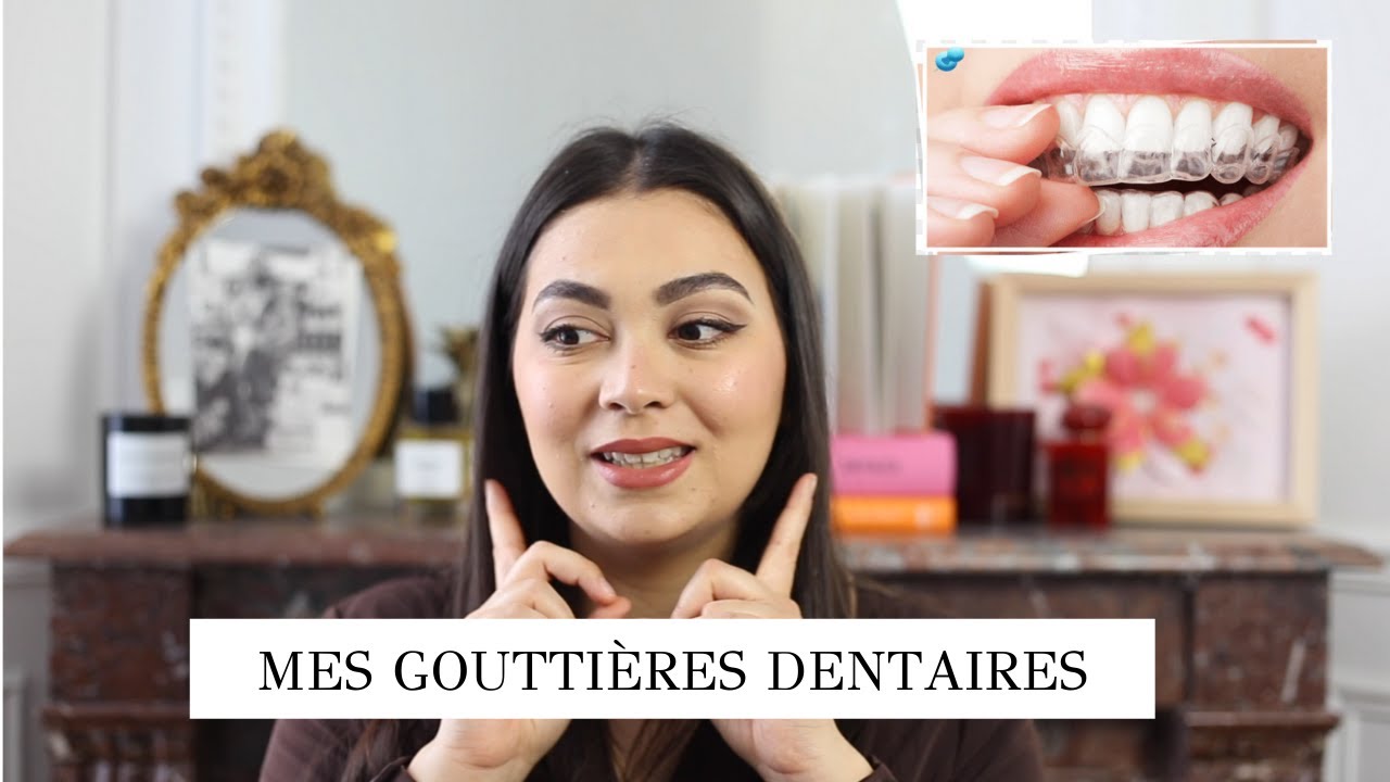 TOUT SAVOIR SUR MON TRAITEMENT DE GOUTTIÈRES DENTAIRES (PRIX ? ÇA MARCHE ? DOULEUR ?...)
