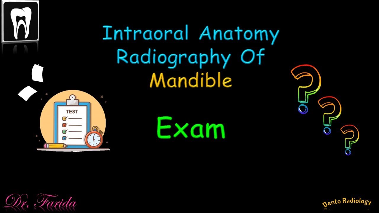 Normal radiographic anatomical landmarks/Intraoral Radiographic Anatomy of the Mandible/ Dental exam