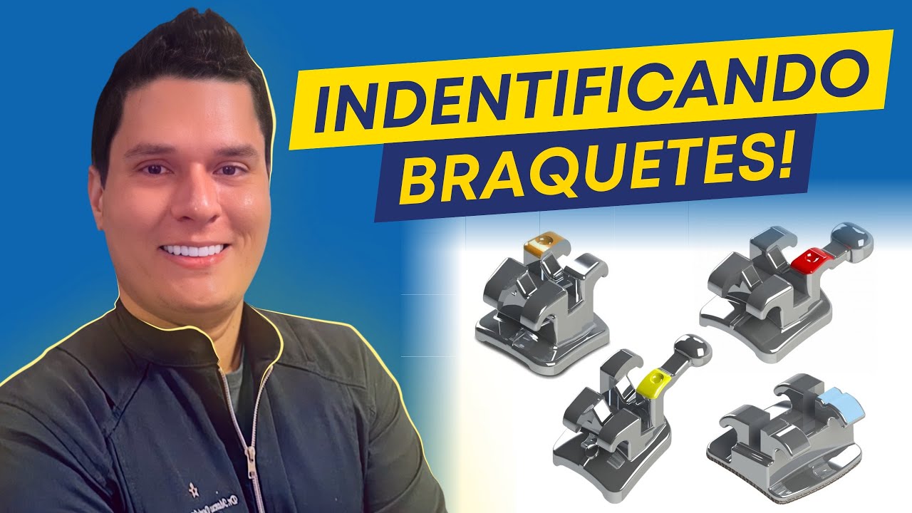 Como identificar os Braquetes em Ortodontia?
