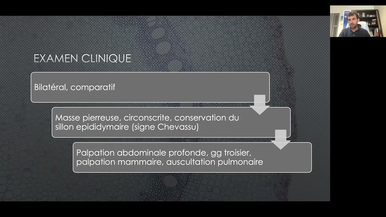 Item 313   Tumeurs du testicule