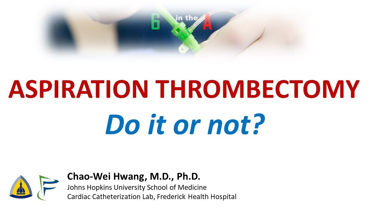 Aspiration Thrombectomy: Clinical Evidence