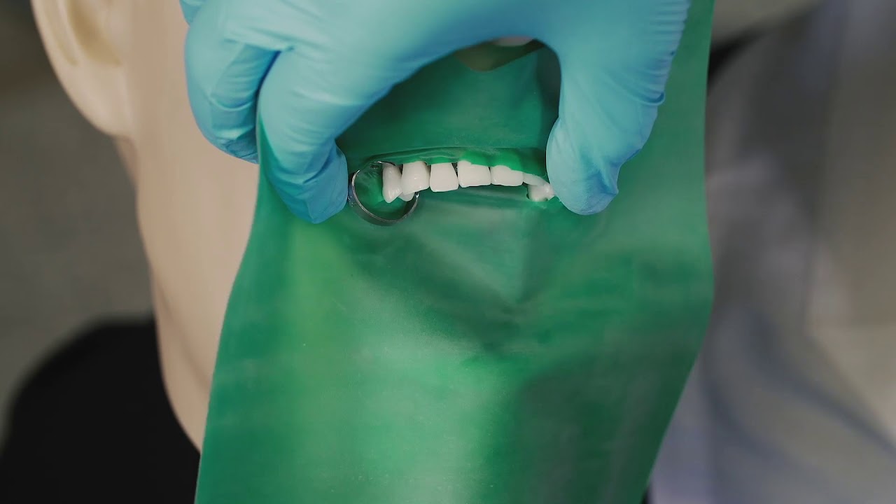 Clamp Placements Using Split Dental Dam