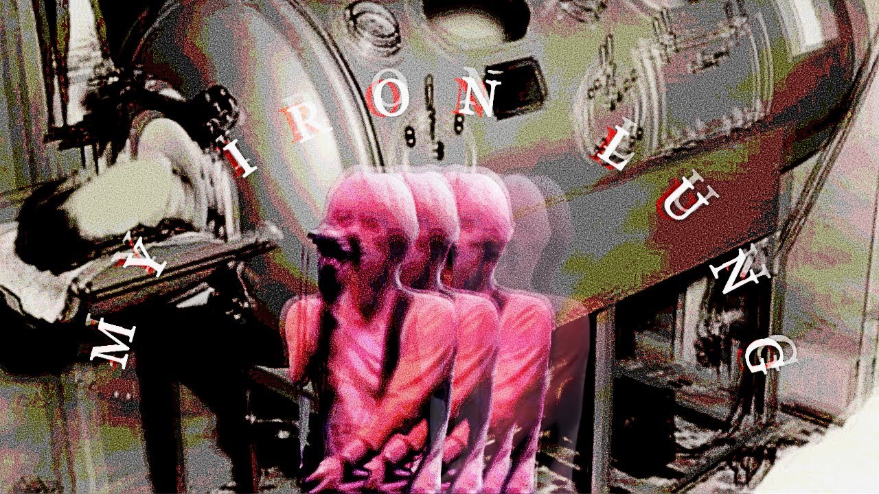 MY IRON LUNG : radiohead : The Bends