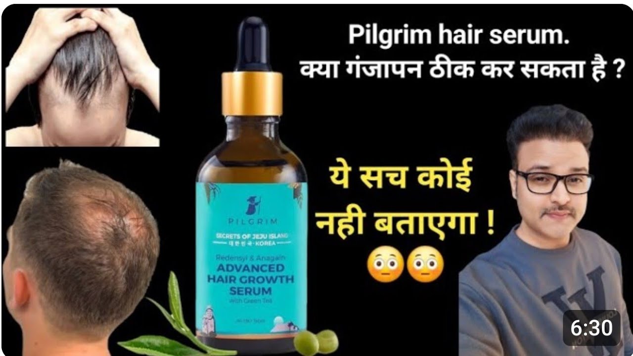 Pilgrim hair regrowth serum review. क्या ये गंजापन खत्म करता है ?