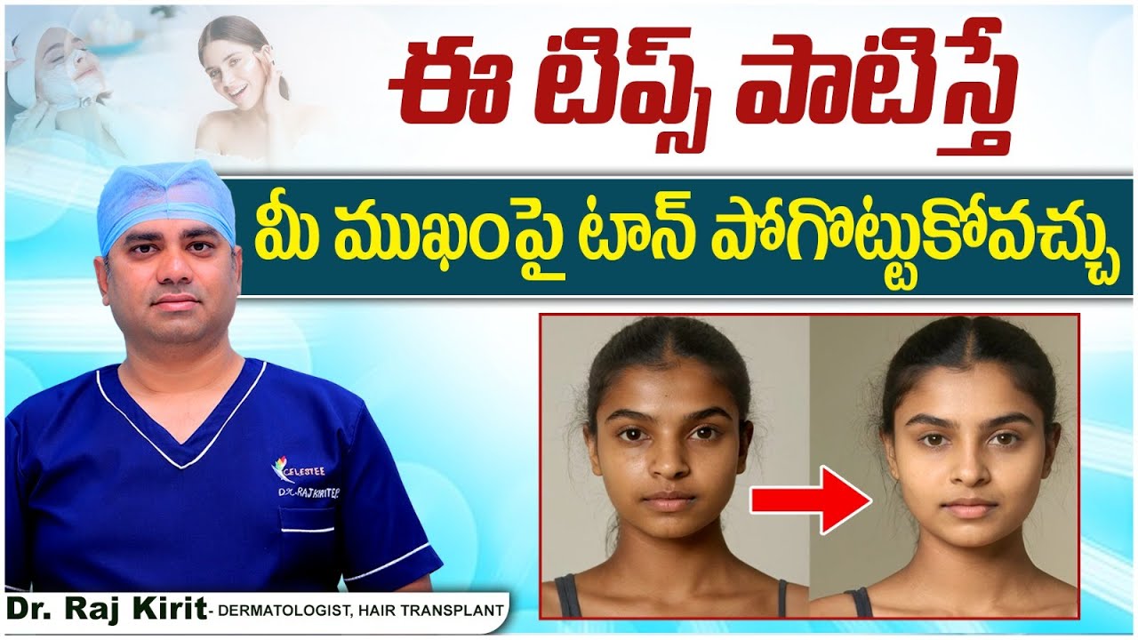 How To Remove Tan On Face In Telugu | Best Treatment For Tan Removal | Celestee Skin And Hair Clinic
