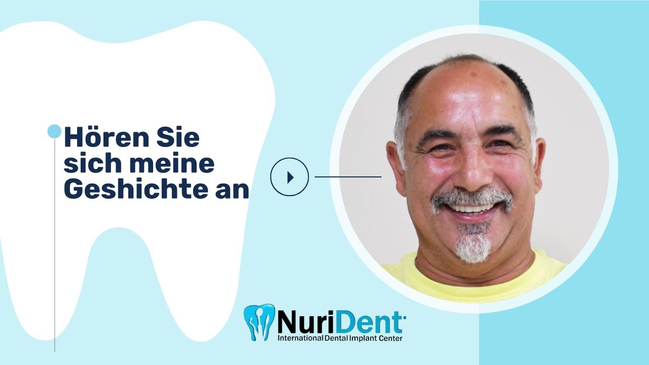 Wiederherstellung des Lächelns - zahnimplantat - in 3 Tagen