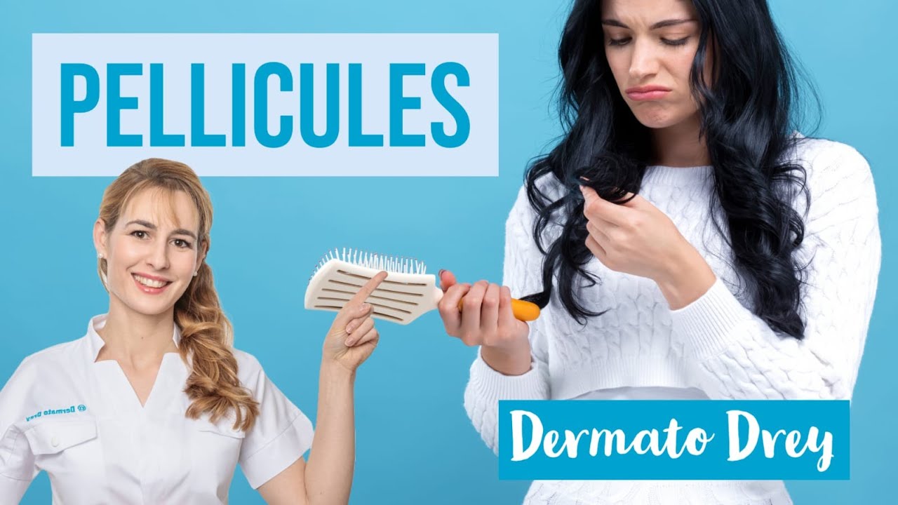 Pellicules : tout savoir sur la dermite séborrhéique @Dermato Drey