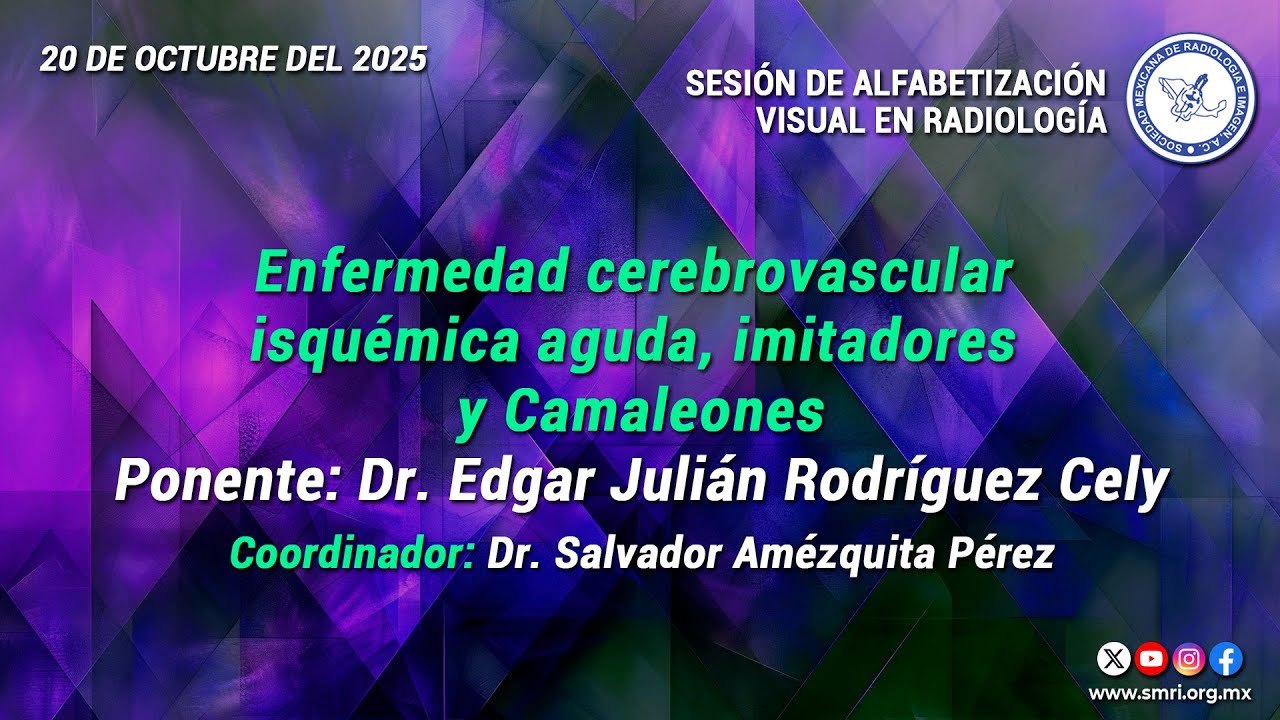 Enfermedad cerebrovascular isquémica aguda, imitadores y Camaleones