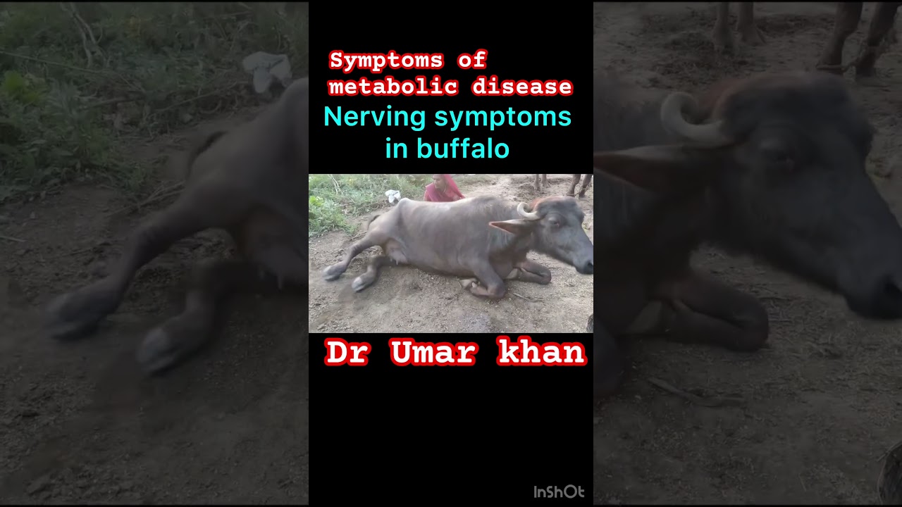 Metabolic disease l Nerving symptoms l dr Umar khan