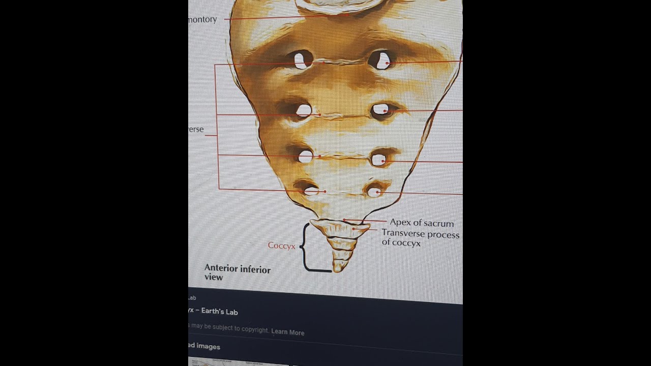 # ألام أسفل الظهر#ألام #العصعص#