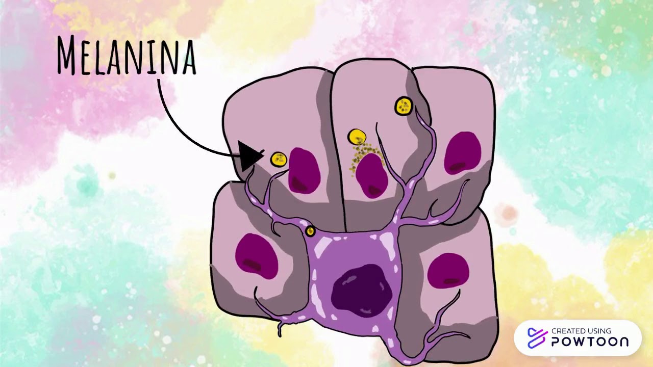 Albinismo