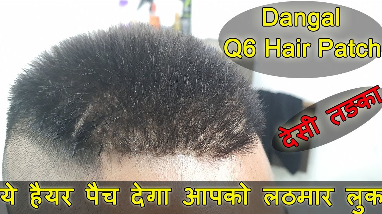 Q6 Hair Patch in Delhi | Best Finishing Customized Frontline Men's Hair Style by Phc | 9899746489