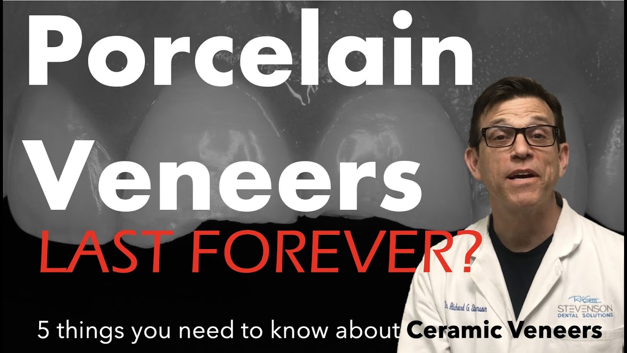 Ceramic Veneers: 5 Things You Should Know About Ceramic Veneers