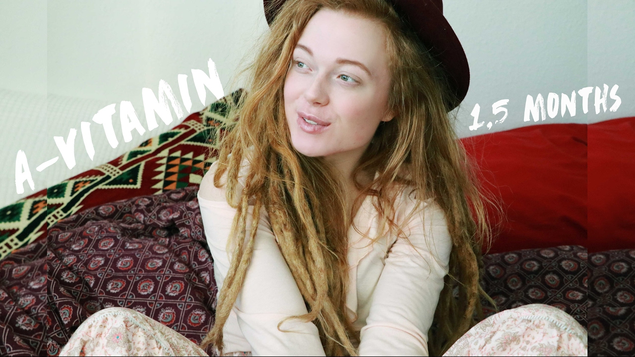 My Experience with A-Vitamin Against Acne | 1,5 Months In