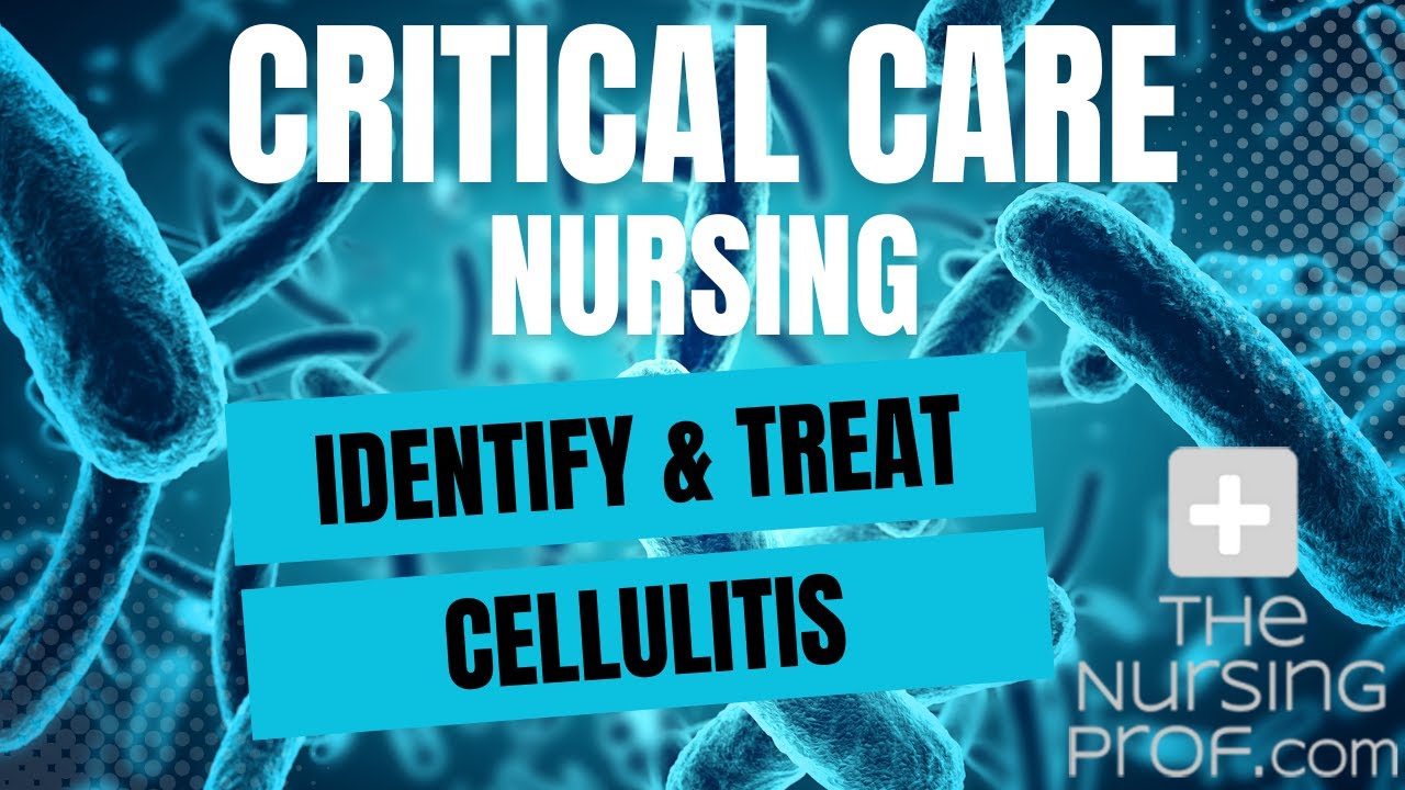 Critical Care Nursing: Identify and Treat Cellulitis