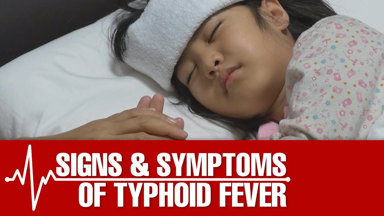 Signs and Symptoms of Typhoid Fever